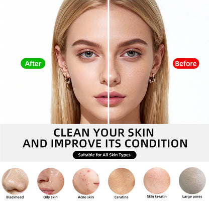 Trilya GlowPro Hot & Cold Facial Pore Cleaner