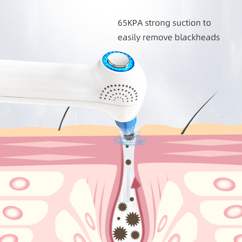 Trilya PoreFresh Blackhead & Pore Vacuum (Hot + Cold)
